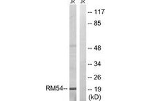 Western blot analysis of extracts from Jurkat cells, using MRPL54 Antibody.