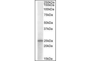 Image no. 1 for anti-Adenylate Cyclase Activating Polypeptide 1 (Pituitary) (ADCYAP1) (C-Term) antibody (ABIN453980) (PACAP anticorps  (C-Term))