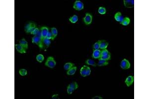 Immunofluorescence staining of MCF-7 cells with ABIN7162123 at 1:133, counter-stained with DAPI. (Occludin anticorps  (AA 285-430))