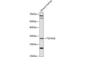 Western blot analysis of extracts of Mouse kidney, using TSP antibody (ABIN7270790) at 1:1000 dilution. (Tetraspanin 6 anticorps  (AA 120-200))