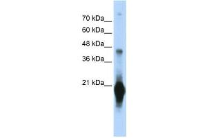 Western Blotting (WB) image for anti-Chromosome 17 Open Reading Frame 49 (C17orf49) antibody (ABIN2459653) (C17orf49 anticorps)