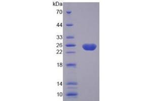 SDS-PAGE of Protein Standard from the Kit  (Highly purified E. (Caspase 8 Kit ELISA)