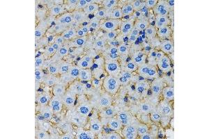 Immunohistochemistry of paraffin-embedded rat liver using RAF1 antibody.