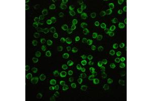 IHC analysis of CIAS1/NALP3 using anti-CIAS1/NALP3 antibody .
