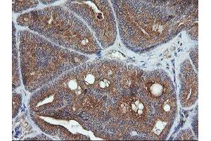 Image no. 6 for anti-Ubiquitin-Conjugating Enzyme E2G 2 (UBE2G2) antibody (ABIN1501630)