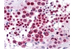 Immunohistochemistry (IHC) image for anti-High Mobility Group Box 2 (HMGB2) (AA 1-196) antibody (ABIN614619)