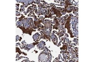 Immunohistochemical staining of human lung with DNHD1 polyclonal antibody  shows strong cytoplasmic positivity in macrophages. (DNHD1 anticorps)