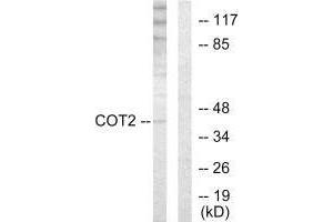 Western blot analysis of extracts from HUVEC cells, using COT2 antibody. (NR2F2 anticorps  (N-Term))