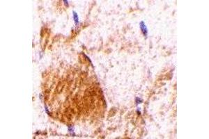 Immunohistochemistry (IHC) image for anti-Interleukin 31 (IL31) (N-Term) antibody (ABIN1031414) (IL-31 anticorps  (N-Term))
