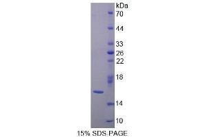 SDS-PAGE (SDS) image for Lectin, Galactoside-Binding, Soluble, 9B (LGALS9B) (AA 17-148) protein (His tag) (ABIN1170505) (LGALS9B Protein (AA 17-148) (His tag))