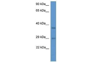 Western Blot showing Med19 antibody used at a concentration of 1. (MED19 anticorps  (N-Term))