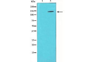 Western blot analysis of p130 Cas expression in NIH-3T3 whole cell lysates,The lane on the left is treated with the antigen-specific peptide.