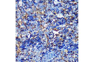 Immunohistochemistry of paraffin-embedded Mouse spleen using C Rabbit pAb (ABIN7266547) at dilution of 1:100 (40x lens).