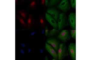 ABIN6258311 and ABIN6274239 staining  cells by IF/ICC.