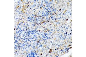 Immunohistochemistry of paraffin-embedded rat spleen using C Rabbit mAb (ABIN7266125) at dilution of 1:100 (40x lens). (CARD11 anticorps)