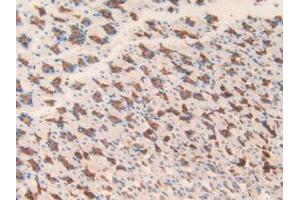 Figure. (MGST1 anticorps  (AA 8-155))