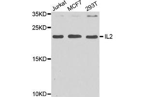Western blot analysis of extract of various cells, using IL2 antibody. (IL-2 anticorps)