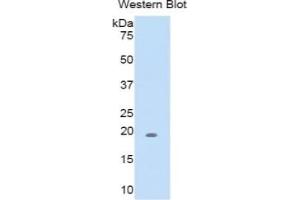 WB of Protein Standard: different control antibodies against Highly purified E.
