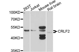 Western blot analysis of extracts of various cell lines, using CRLF2 antibody. (CRLF2 anticorps)
