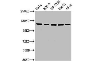Western Blot Positive WB detected in: Hela whole cell lysate, MCF-7 whole cell lysate, SH-SY5Y whole cell lysate, HepG2 whole cell lysate, A549 whole cell lysate All lanes: USP48 antibody at 3. (USP48 anticorps  (AA 358-508))