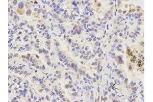 Immunohistochemistry (IHC) image for anti-Autophagy related 4A Cysteine Peptidase (ATG4A) antibody (ABIN1871138) (ATG4A anticorps)