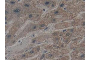 Detection of MYH10 in Human Liver Tissue using Polyclonal Antibody to Myosin Heavy Chain 10, Non Muscle (MYH10)