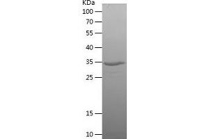 Western Blotting (WB) image for Survival of Motor Neuron 1, Telomeric (SMN1) (AA 73-173) protein (His-IF2DI Tag) (ABIN7125138)