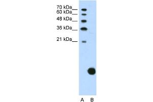 WB Suggested Anti-RPS29 Antibody Titration:  1. (RPS29 anticorps  (N-Term))