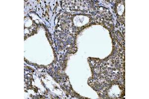 IHC analysis of NDUFS6 using anti-NDUFS6 antibody (ABIN7599568).