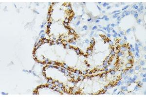 Immunohistochemistry of paraffin-embedded Mouse kidney using ETHE1 Polyclonal Antibody at dilution of 1:100 (40x lens).