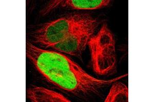 Immunofluorescent staining of U-2 OS with TPX2 polyclonal antibody  (Green) shows positivity in nucleus but excluded from the nucleoli. (TPX2 anticorps)
