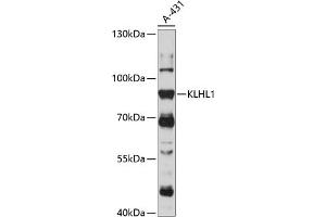 Western blot analysis of extracts of A-431 cells, using KLHL1 antibody (ABIN7268077) at 1:1000 dilution.