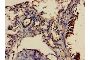 Immunohistochemistry of paraffin-embedded human lung tissue using ABIN7158098 at dilution of 1:100 (SHoc2/Sur8 anticorps  (AA 3-89))