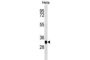 Western blot analysis in Hela cell line lysates (35µg/lane) using CAPG Antibody . (CAPG anticorps  (Middle Region))