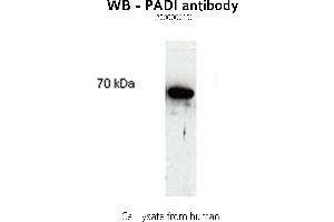 Image no. 1 for anti-Peptidyl Arginine Deiminase, Type II (PADI2) antibody (ABIN346986) (PADI2 anticorps)