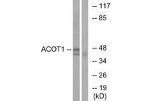 Western blot analysis of extracts from Jurkat cells, using ACOT1 Antibody. (ACOT1 anticorps  (AA 91-140))
