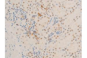 ABIN6267271 at 1/100 staining rat kidney tissue sections by IHC-P. (c-MYC anticorps  (pSer62))