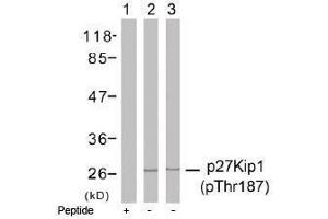 Image no. 1 for anti-Cyclin-Dependent Kinase Inhibitor 1B (p27, Kip1) (CDKN1B) (pThr187) antibody (ABIN196946) (CDKN1B anticorps  (pThr187))