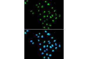 Immunofluorescence analysis of MCF-7 cells using EIF6 antibody. (EIF6 anticorps)