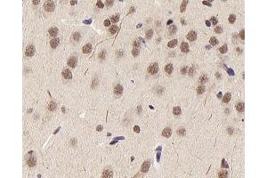Immunohistochemistry analysis of paraffin-embedded rat brain using HDAC1 Polyclonal Antibody at dilution of 1:300. (HDAC1 anticorps)