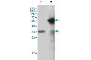 Western blot analysis using MLL monoclonal antibody, clone 10F8D7  against truncated MLL recombinant protein (1) and truncated GFP-MLL(aa 3714-3969) transfected COS-7 cell lysate (2). (MLL/KMT2A anticorps)