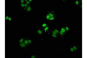 Immunofluorescence staining of Hela cells with ABIN7139609 at 1:5, counter-stained with DAPI.