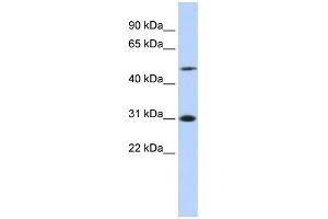 WB Suggested Anti-ING3 Antibody Titration:  0. (ING3 anticorps  (N-Term))