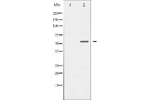 Western blot analysis of MEF2A phosphorylation expression in UV treated K562 whole cell lysates,The lane on the left is treated with the antigen-specific peptide.