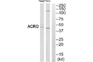 Western blot analysis of extracts from HEPG2 cells and COLO cells, using ACRO (heavy chain, Cleaved-Ilantibody. (Acrosin anticorps  (Cleaved-Ile43, Heavy Chain))
