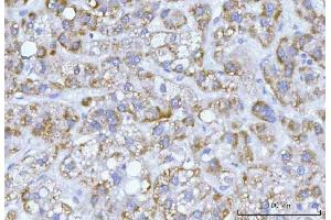 IHC analysis of Hamartin/TSC1 using anti-Hamartin/TSC1 antibody (ABIN7599499). (TSC1 anticorps  (AA 1-618))