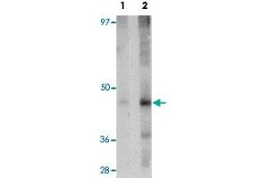 Western blot analysis of rat liver tissue with NR1H3 polyclonal antibody  at (Lane 1) 1 and (Lane 2) 2 ug/mL dilution.