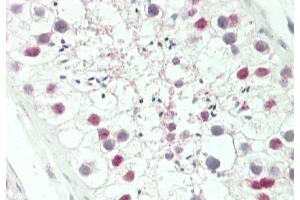 Formalin-fixed and paraffin-embedded H.