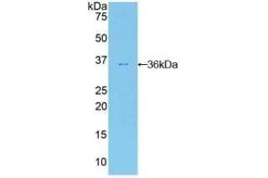 Detection of Recombinant FDFT1, Human using Polyclonal Antibody to Farnesyl Diphosphate Farnesyltransferase 1 (FDFT1) (FDFT1 anticorps  (AA 269-417))