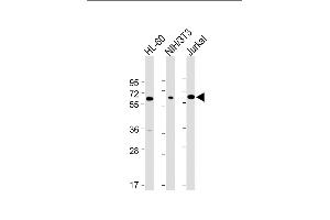 All lanes : Anti-ME2 Antibody (C-term) at 1:4000 dilution Lane 1: HL-60 whole cell lysate Lane 2: NIH/3T3 whole cell lysate Lane 3: Jurkat whole cell lysate Lysates/proteins at 20 μg per lane. (NAD-ME anticorps  (C-Term))